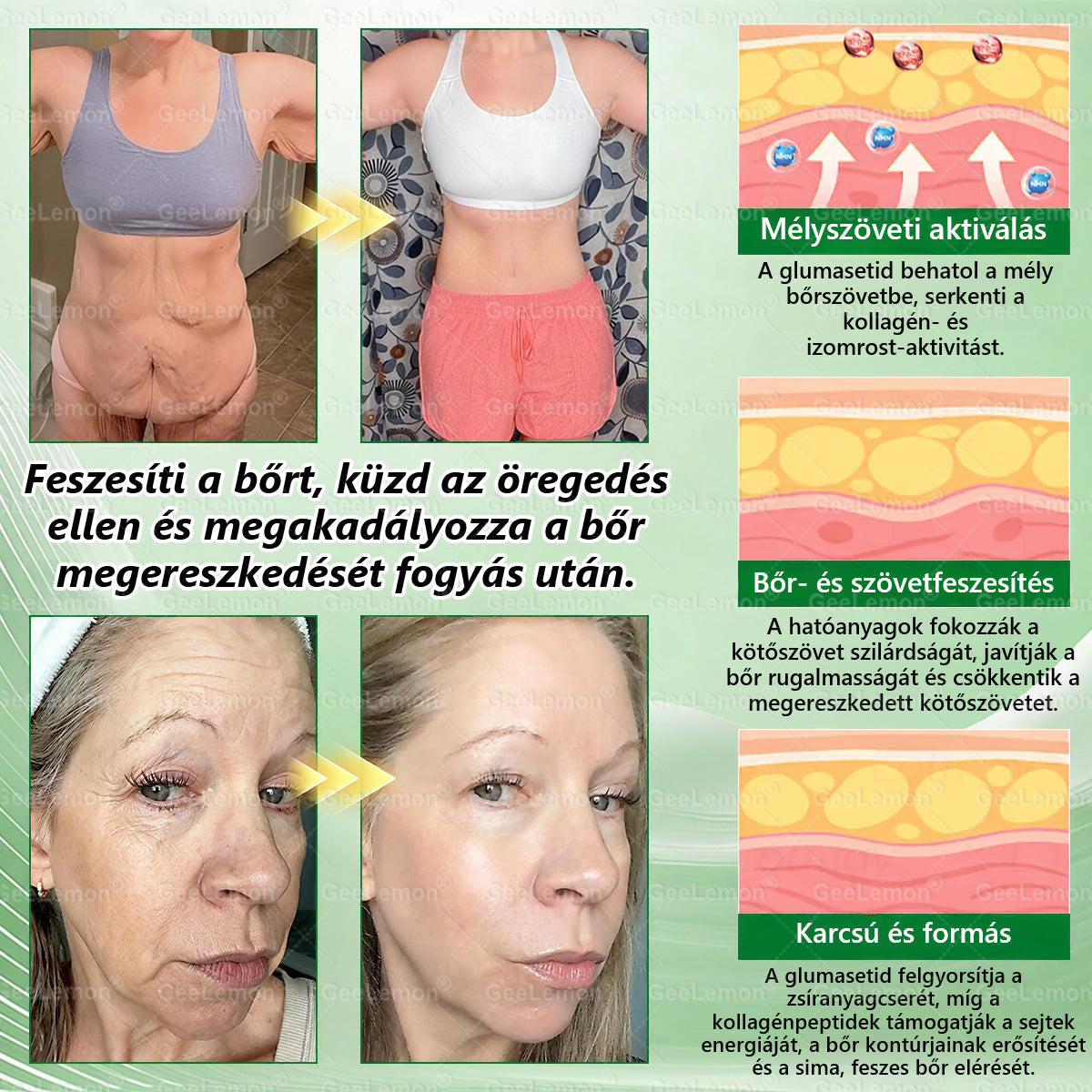 Geelemon®  Glumasetide 8 az 1-ben Karcsú és Egészséges Nano Mikrotűs Tapasz