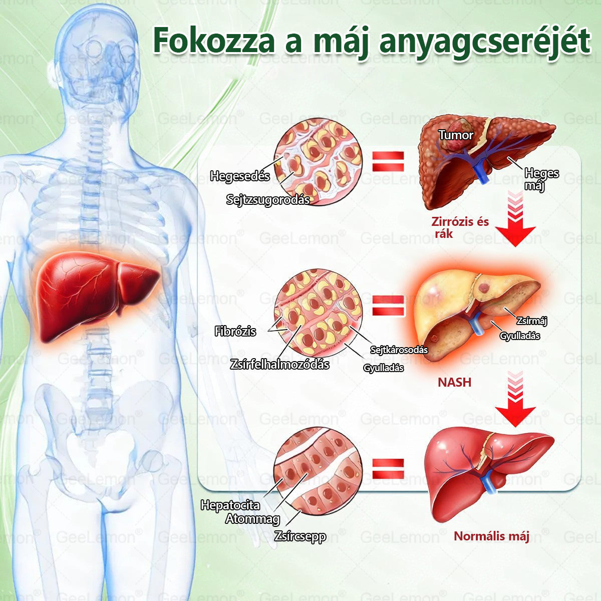🔥GeeLemon® Glumasetide 8az 1-ben Karcsú és EgészségesNano Mikrotűs Tapasz (Napi 1alkalom – látható változásakár 7 nap alatt) ✅ Elhízásra,bőrfeszesítésre,cukorbetegségre, alvásiapnoéra, ízületekre stb 4.