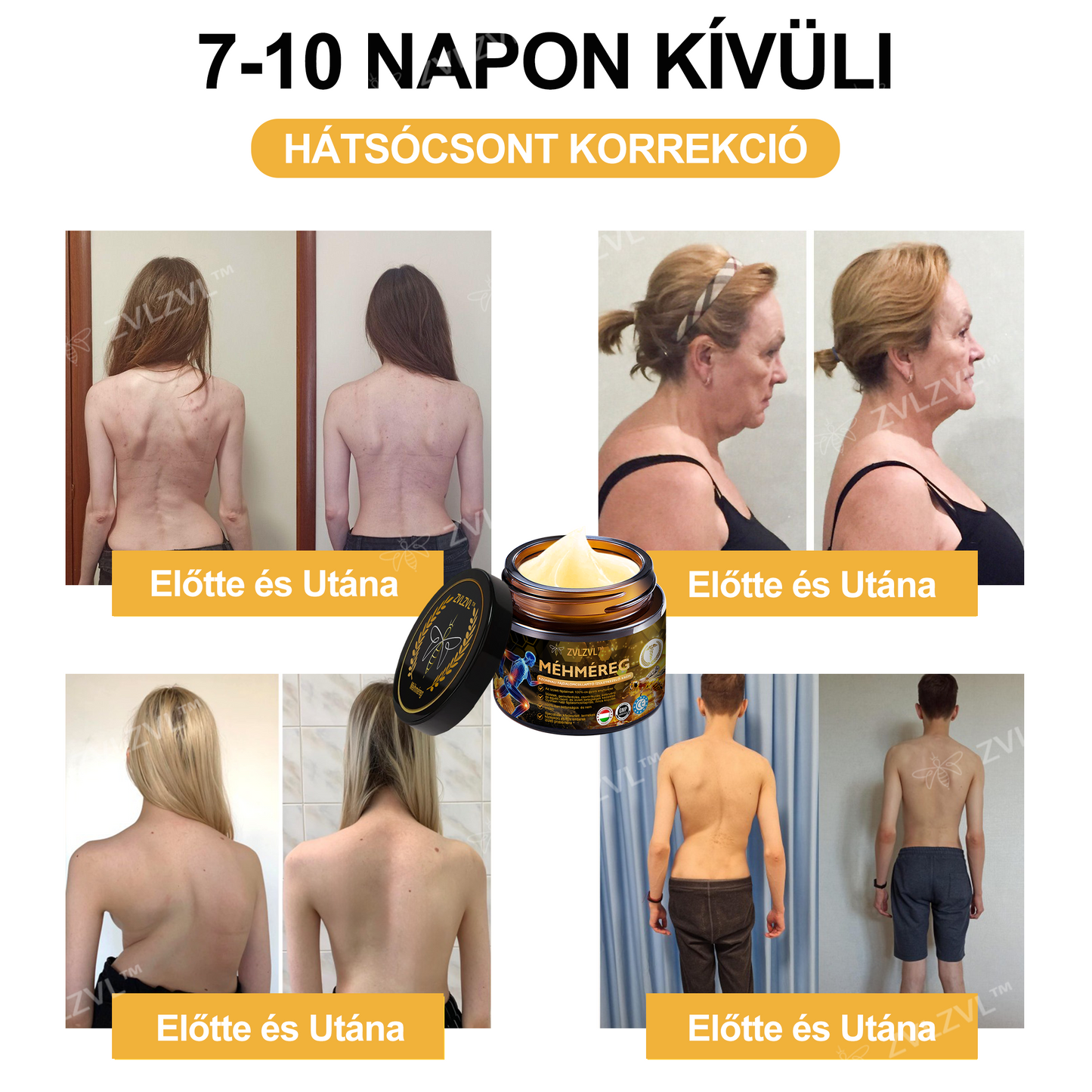 𝐇𝐢𝐯𝐚𝐭𝐚𝐥𝐨𝐬 𝐮̈𝐳𝐥𝐞𝐭: 𝐙𝐕𝐋𝐙𝐕𝐋®𝐌𝐞́𝐡𝐦𝐞́𝐫𝐞𝐠𝐞𝐬 𝐊𝐫𝐞́𝐦 – 𝐀𝐳𝐨𝐧𝐧𝐚𝐥𝐢, 𝐮𝐥𝐭𝐫𝐚𝐞𝐫𝐨̋𝐬 𝐟𝐚́𝐣𝐝𝐚𝐥𝐨𝐦𝐜𝐬𝐢𝐥𝐥𝐚𝐩𝐢́𝐭𝐨́ (Enyhíti az ízületi gyulladás okozta fájdalmat, az izomfájdalmat, a hátfájást, a térd-, váll-, csípő-, csukló- és kézfájdalmat.)