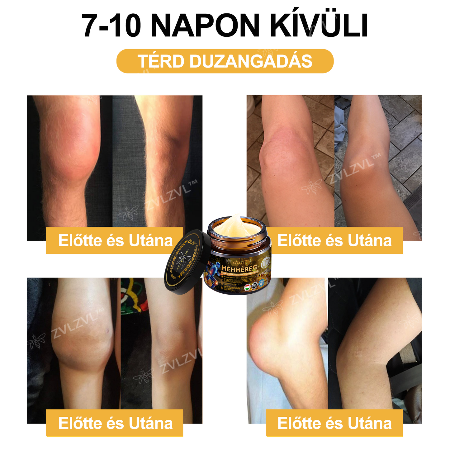 🎁 Már csak 5 doboz maradt! Most további 30% kedvezmény! Támogasd ízületeid egészségét és a könnyed mozgást. Ha most kihagyod, legközelebb csak jövőre lesz rá lehetőség!