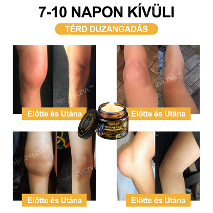 🎁 Már csak 5 doboz maradt! Most további 30% kedvezmény! Támogasd ízületeid egészségét és a könnyed mozgást. Ha most kihagyod, legközelebb csak jövőre lesz rá lehetőség!
