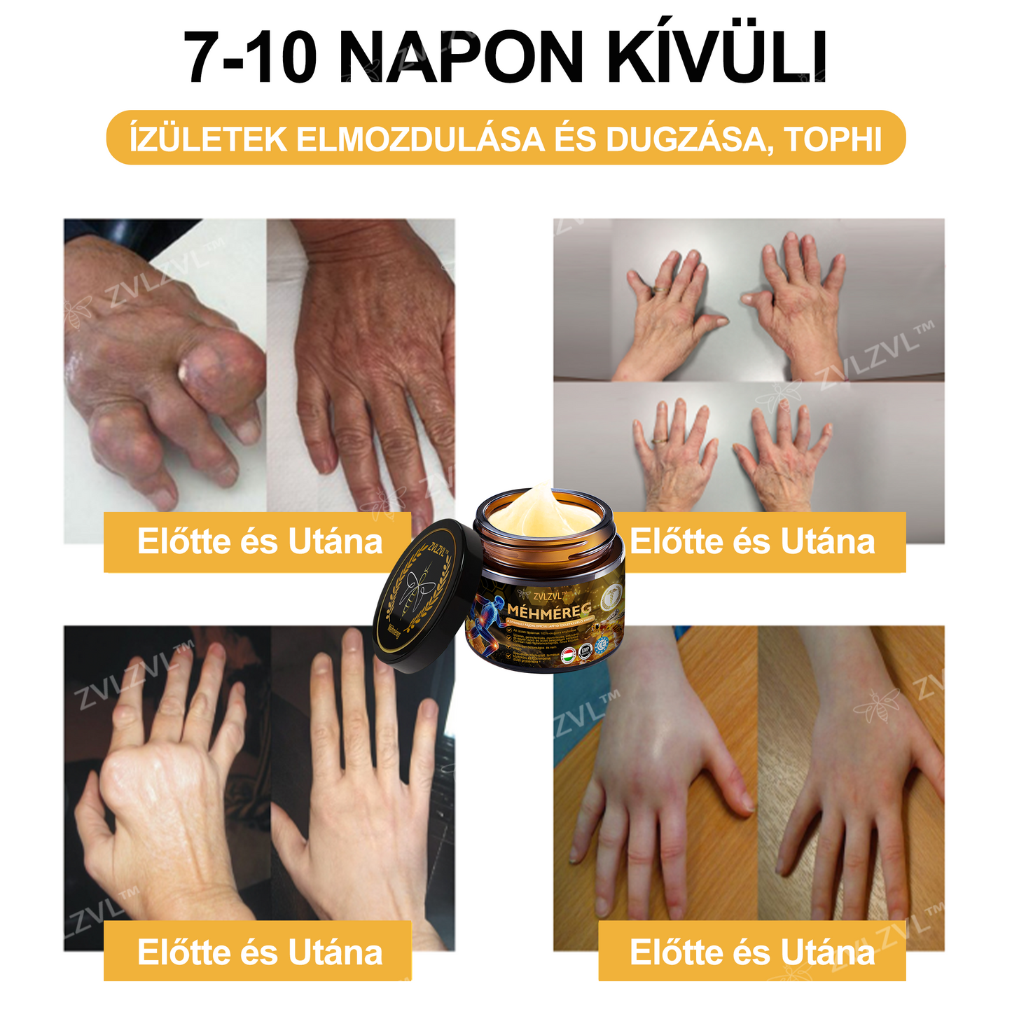 𝐇𝐢𝐯𝐚𝐭𝐚𝐥𝐨𝐬 𝐮̈𝐳𝐥𝐞𝐭: 𝐙𝐕𝐋𝐙𝐕𝐋®𝐌𝐞́𝐡𝐦𝐞́𝐫𝐞𝐠𝐞𝐬 𝐊𝐫𝐞́𝐦 – 𝐀𝐳𝐨𝐧𝐧𝐚𝐥𝐢, 𝐮𝐥𝐭𝐫𝐚𝐞𝐫𝐨̋𝐬 𝐟𝐚́𝐣𝐝𝐚𝐥𝐨𝐦𝐜𝐬𝐢𝐥𝐥𝐚𝐩𝐢́𝐭𝐨́ (Enyhíti az ízületi gyulladás okozta fájdalmat, az izomfájdalmat, a hátfájást, a térd-, váll-, csípő-, csukló- és kézfájdalmat.)