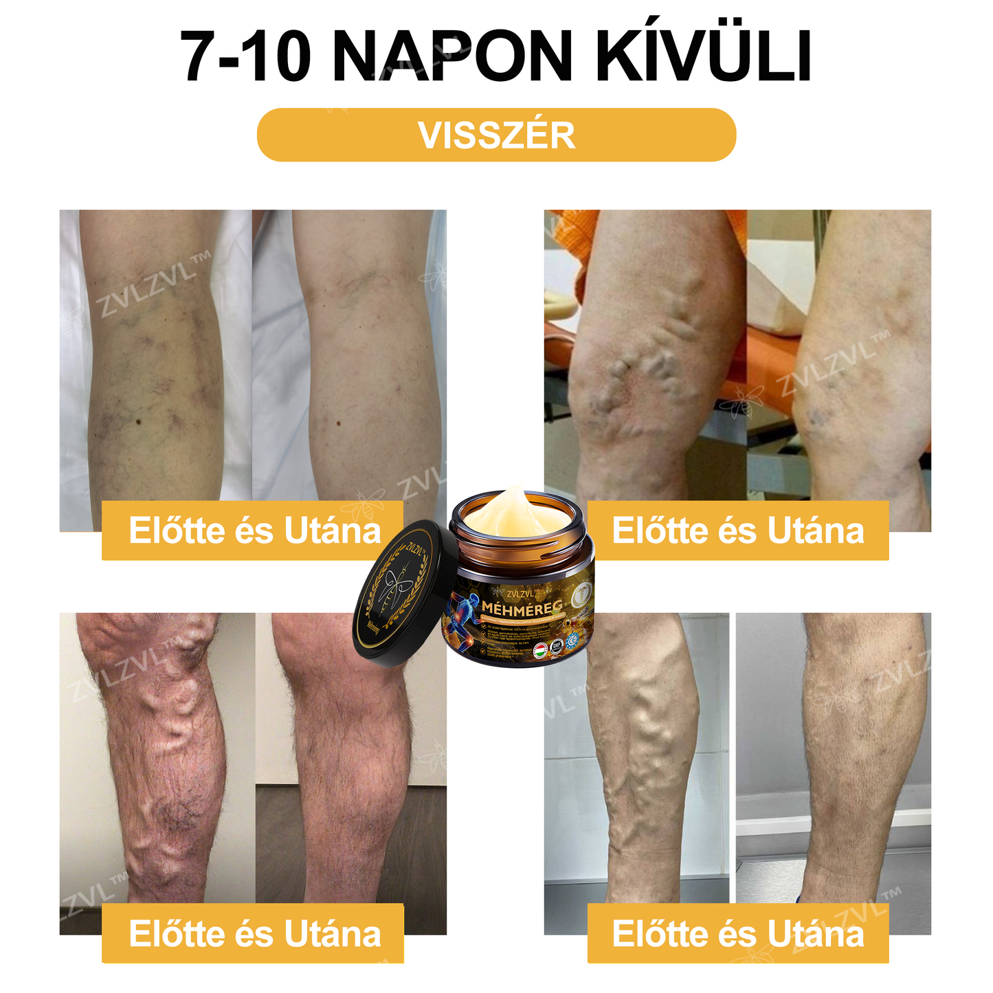 🎁 Már csak 5 doboz maradt! Most további 30% kedvezmény! Támogasd ízületeid egészségét és a könnyed mozgást. Ha most kihagyod, legközelebb csak jövőre lesz rá lehetőség!
