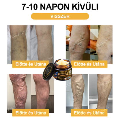 🎁 Már csak 5 doboz maradt! Most további 30% kedvezmény! Támogasd ízületeid egészségét és a könnyed mozgást. Ha most kihagyod, legközelebb csak jövőre lesz rá lehetőség!