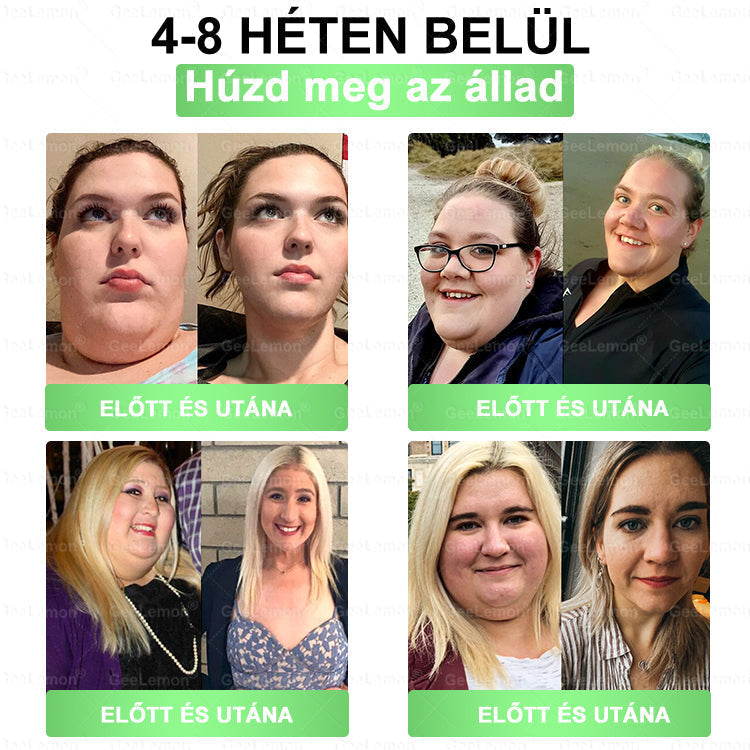 🔥GeeLemon® Glumasetide 8az 1-ben Karcsú és EgészségesNano Mikrotűs Tapasz (Napi 1alkalom – látható változásakár 7 nap alatt) ✅ Elhízásra,bőrfeszesítésre,cukorbetegségre, alvásiapnoéra, ízületekre stb 2.