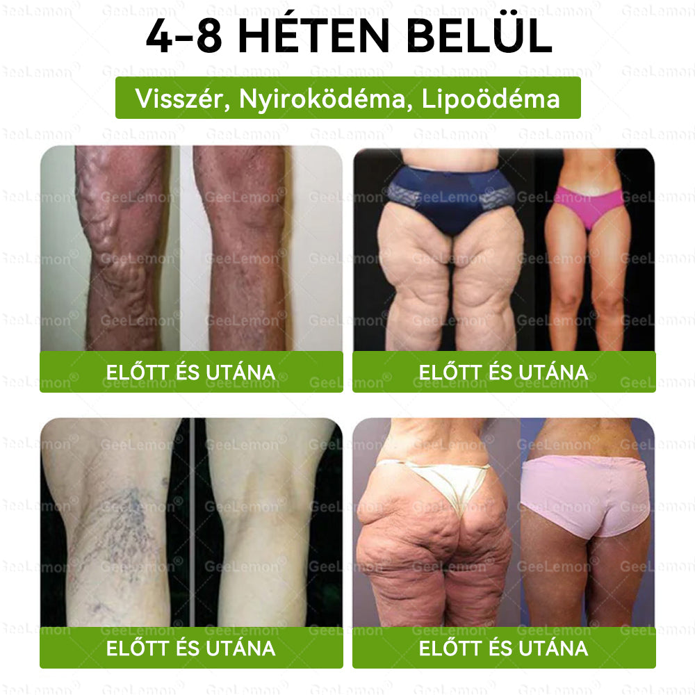 🎁 Már csak 5 doboz maradt! Most további 30% kedvezményt adunk! Legyél fitt és egészséges. Ha most nem élsz a lehetőséggel, legközelebb csak jövőre lesz rá esélyed!