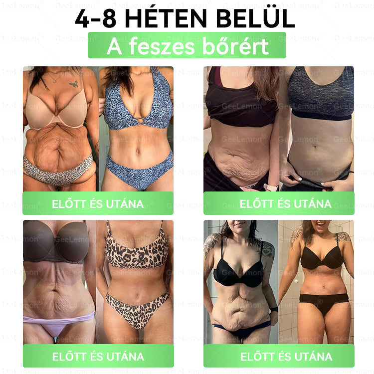 🔥GeeLemon® Glumasetide 8az 1-ben Karcsú és EgészségesNano Mikrotűs Tapasz (Napi 1alkalom – látható változásakár 7 nap alatt) ✅ Elhízásra,bőrfeszesítésre,cukorbetegségre, alvásiapnoéra, ízületekre stb 4.